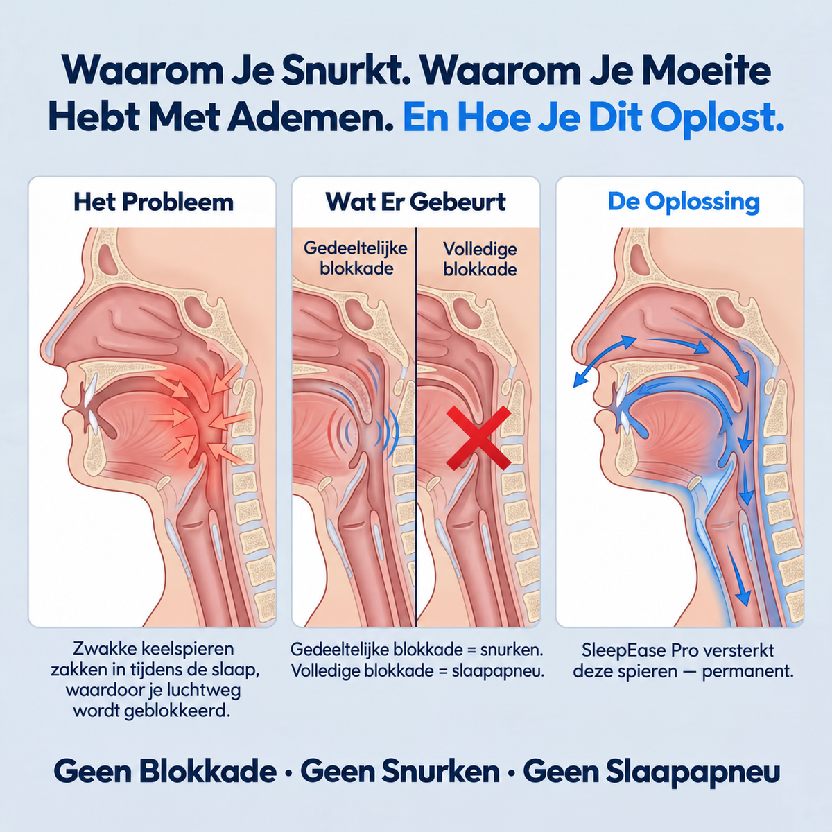 SleepEase Pro — Elimineert snurken en slaapapneu